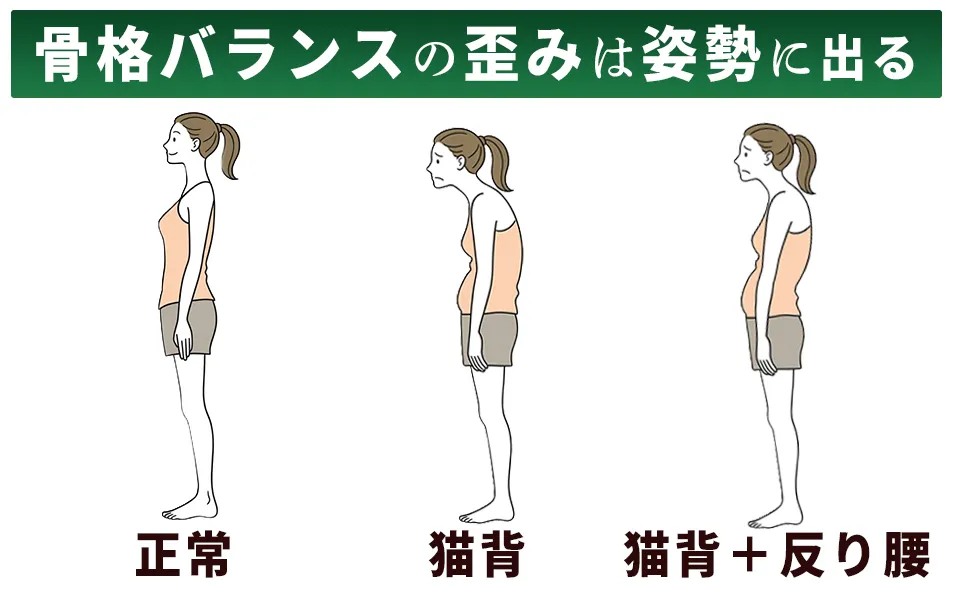 立ち姿勢による猫背反り腰、知立市ハート整体院