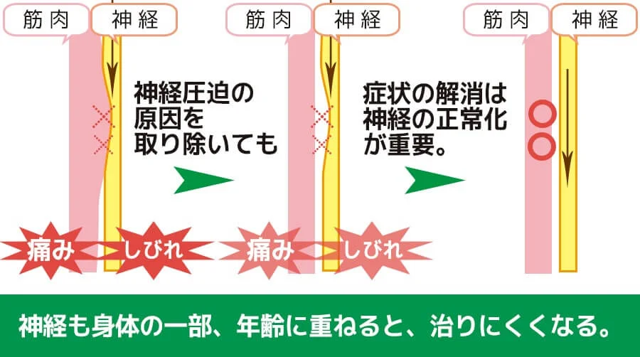神経の圧迫